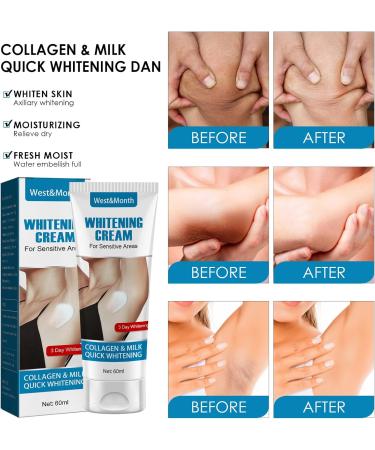 Armpit Whitening Cream Skin Whitening Cream For Underarm Skin Lightening Cream For Whole Body Underarm Whitening Products For Dark Skin & Private Parts Knee Elbows Legs Underarm - Buy Online on SooperMarket.com