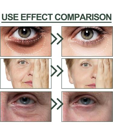 Eye Cream for Dark Circles and Puffy Eyes Jasmine Anti Wrinkle Eye Cream Anti Aging Under Eye Cream Collagen Eye Cream to Revitalise the Eye Area Eye Bags Remover Instant Eye Tightener - Buy Online on SooperMarket.com