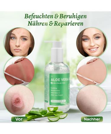 100% Pure Aloe Vera Gel - 280ml Natural Moisturizer for Face Body & Hair | Soothing After Sun Lotion for Dry Skin & Sunburn - Buy Online on SooperMarket.com