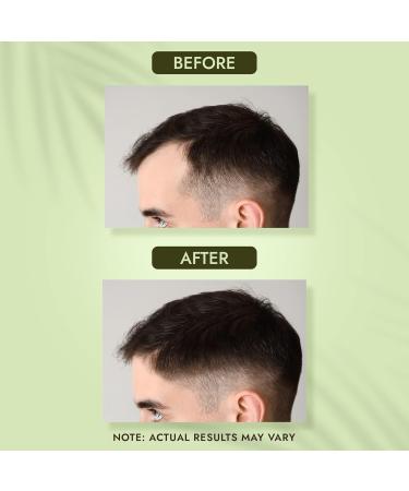 Healthy Long & Strong Herbal Hair Shampoo - Pack of 3 (200ml each) | Nourish & Strengthen Your Hair - Buy Online on SooperMarket.com