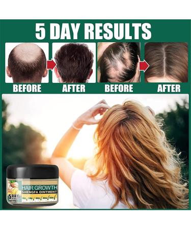 Endxedio Natural Ginger Serum Hair Growth Cream - Boost Moisturizing & Stimulate Hair Follicles for Unisex Hair Loss Treatment (2PCs) - Buy Online on SooperMarket.com