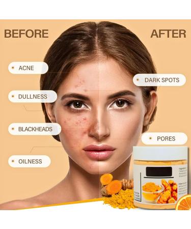 Turmeric Vitamin C Clay Face Mask Turmeric Clay Mask Turmeric Face Mask for Dark Spots Mud Mask Deep Cleansing Face Mask Skin Care Improve Blackheads Acne Dark Spots and Even Out Skin Tone 120g - Buy Online on SooperMarket.com