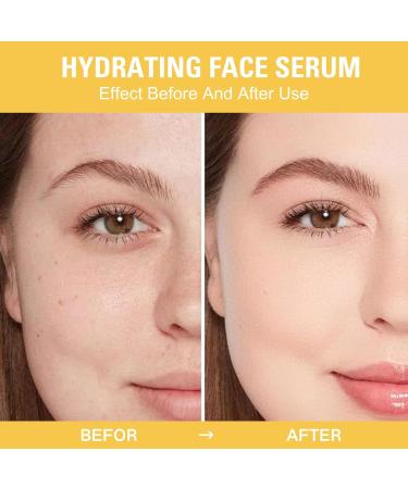 Trendyfave Vitamin C Serum for Face Vitamin C Face Serum Dark Spot Remover for Face Brightening Serum For Anti Wrinkle Reduce Fine Lines Vitamin C Hydrating Serum Serum Skincare Face Care - Buy Online on SooperMarket.com