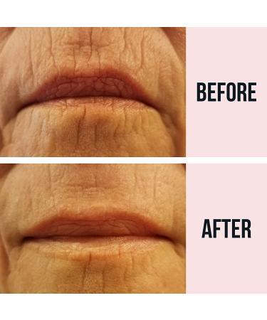 SiO Beauty Super LipLift - Anti-Wrinkle Patches for Lip & Smile | 4 Week Supply for Overnight Smoothing of Fine Lines - Buy Online on SooperMarket.com