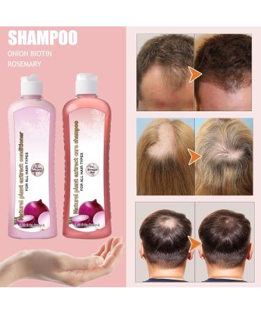 Onion & Rosemary Shampoo for Hair Growth | Biotin Anti Hair Loss Shampoo 16.76 fl oz - Buy Online on SooperMarket.com