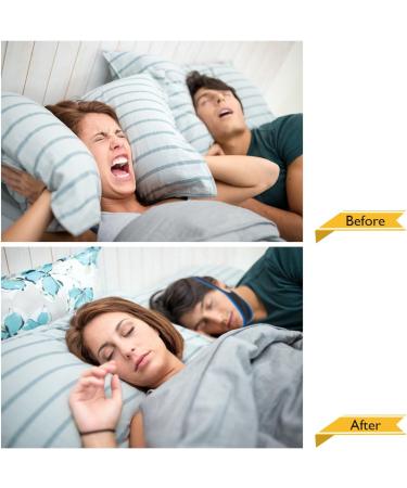 2023 Newest Anti Snoring Chin Strap - Effective Stop Snoring Aid for Men and Women - Adjustable & Breathable - Buy Online on SooperMarket.com