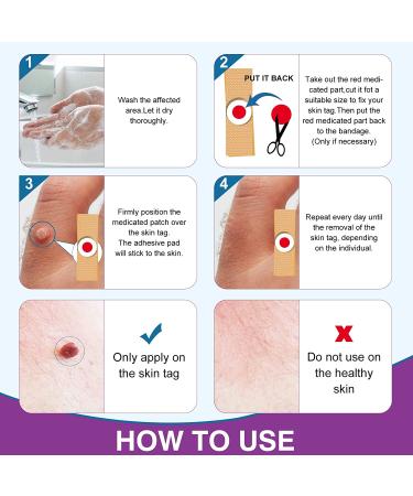 Skin Tag & Wart Remover Pads - Extra Strength, Fast & Safe Removal - 42 Count Pack - Suitable for All Skin Types - Buy Online on SooperMarket.com