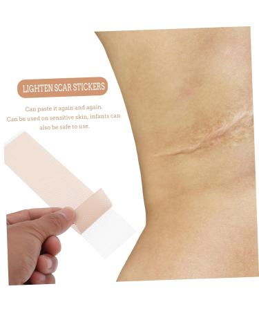 2pcs Waterproof Silica Gel Scar Repair Tape | Silicone Scar Strips Patch Bandages for Body | Nursing Stickers for Scar Management - Buy Online on SooperMarket.com
