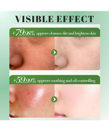 Natural Aloe Vera Gel for Face Pure Aloe Vera Gel Aloevera Gel for Skin Soothing Aloe Vera Face Gel for Women & Men Aloe Vera After Sun Body Face Care for Sunburn Repair Scars Restoring 160g - Buy Online on SooperMarket.com