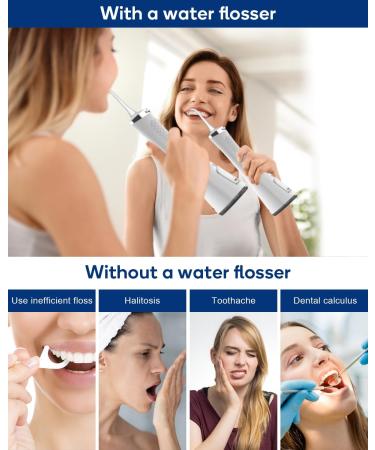 Water Dental Flosser Cordless Oral Irrigator - 5 Cleaning Modes, 4 Jet Tips - IPX7 Waterproof, USB Rechargeable - Teeth Cleaning Tool with PU Bag - White - Buy Online on SooperMarket.com