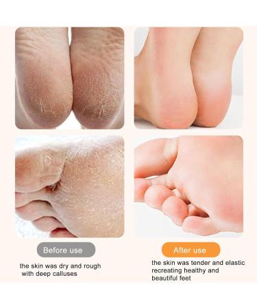 Teksome Electric Foot File - Skin-Friendly Foot Callus Remover Rechargeable Feet Scrubber Automatic Powerful Heel Scraper for Cracked Heels Feet Hard Cracked Dry - Buy Online on SooperMarket.com
