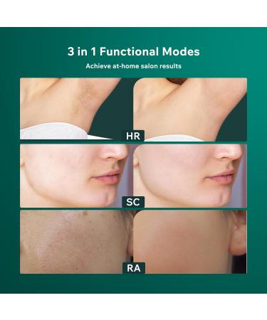 AMINZER 2023 IPL Hair Removal Device 3-in-1 Functions HR/SC/RA | 9 Energy Levels | 999900 Flashes | Painless Laser Hair Removal Device with LCD Touch Screen - Buy Online on SooperMarket.com