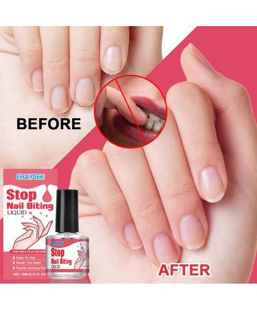 Quick Drying Anti Nail Biting Nail Polish - Nail Biting Prevention For Kids - Stop Nail Biting Nail Varnish - Nail Biting Prevention For Adults & Children Fast And Easy Application - Buy Online on SooperMarket.com