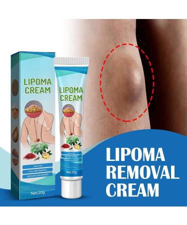Lipoma Removal Cream 20g - Natural Treatment for Lipoma Care & Discomfort - Buy Online on SooperMarket.com