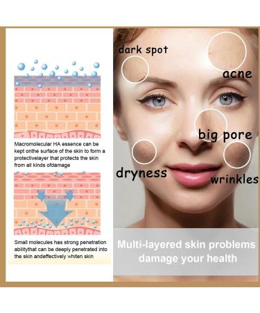Rice Toner 150ML Smoothing Pore Minimizer & Moisturising Facial Toner - Niacinamide Essence for Dry Skin - Redness & Exfoliating - 1pc - Buy Online on SooperMarket.com