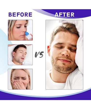 Anti Snoring Nasal Strips 120 Pcs - Reduce Snoring, Improve Sleep & Relieve Nasal Congestion - Buy Online on SooperMarket.com