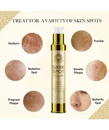 Dark Spot Corrector for Face & Body | Age & Sun Spots Remover with Kojic Acid & Vitamin C | All Skin Types | 1 fl oz - Buy Online on SooperMarket.com