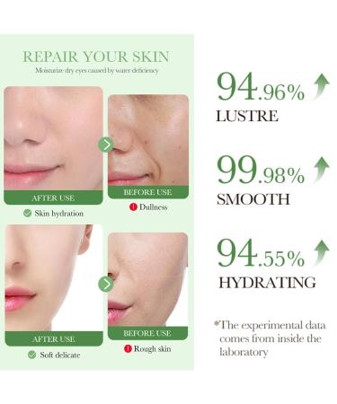 Centella Asiatica Soothing Repair Facial Serum | Lightweight Hydrating Daily Moisturizer | Anti-Acne & Oil Control | 30ml - International Shipping - Buy Online on SooperMarket.com