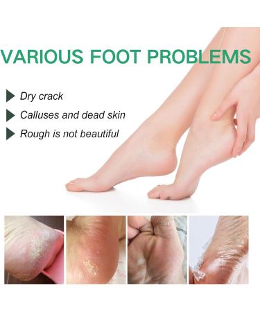 Foot Cream for Very Dry Feet Cracked Heel Repair Cream Callus Remover Foot Moisturiser Hard Skin Remover Foot Soften & Smooths Feet Deep Moisturizing Nourishing Formula for Feet Care - Buy Online on SooperMarket.com