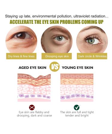 Retinol Eye Cream & 24k Under Eye Patches Kit - Anti-Aging Dark Circles & Puffy Eyes Treatment - Moisturizing & Firming Formula - Buy Online on SooperMarket.com