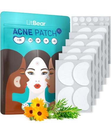 LitBear 84 Patches 5 Size Acne Patches Large Hydrocolloid Pimple Patches for Large Breakouts Zit and Blemish Large Acne Patches for Face Chin Back and Body with Tea Tree Oil