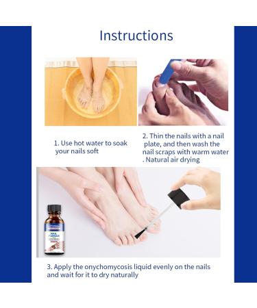 Fungal Nail Treatment For Toenails - Extra Strong Nail Fungus Treatment for Toenail - Toe Nail Fungal Treatment - Anti-Fungal Nail Repair Treatment with Nail File and Nail Brush - Buy Online on SooperMarket.com