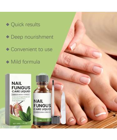 Nail Nourishing Solution | Multifunctional Nail Repair Drops | Nail Strengthening Drops | Hydrating Nail | Natural Nail Repair Remedy |-Infused Nail - Buy Online on SooperMarket.com