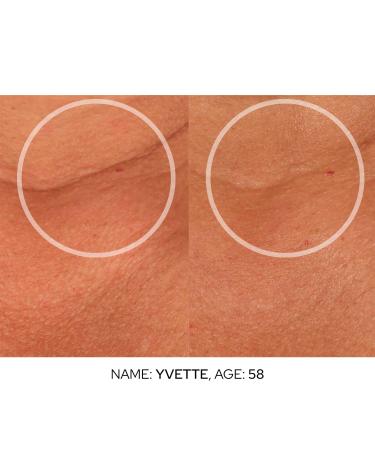 SiO Cryo Neck & D collet Cream | Firming & Smoothing Treatment for Youthful Skin - Shop Internationally - Buy Online on SooperMarket.com