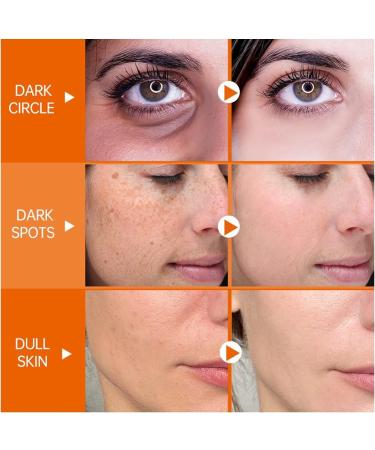 Shefave Vitamin C Serum for Face - Dark Spot Remover - Face Serum with 30x Vitamin C and Hyaluronic Acid - Anti-Dark Spot Serum - Fading Dark Spots for Tired Pale Skin - Buy Online on SooperMarket.com