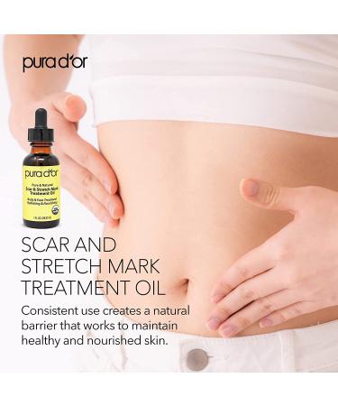 PURA DOR Organic Scar & Stretch Mark Treatment Oil | 1oz For Skin - Rosehip, Wheat Germ, Argan, Tamanu, Carrot, Rosemary, Lavender, Geranium, Patchouli, Sage - Buy Online on SooperMarket.com