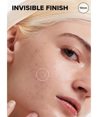 I DEW CARE Hydrocolloid Acne Pimple Patch and Chill Kitten Moisturizer Bundle - Buy Online on SooperMarket.com