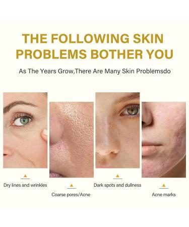 50% Citric Acid Peeling Serum for Face | Skin Peel Solution for Dark Spots & Acne | Exfoliating Chemical Peel 30ml - Buy Online on SooperMarket.com