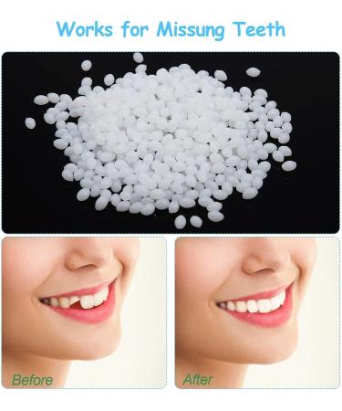 Buy Flipped Warm Veneers Teeth Set - Top & Bottom Artificial Braces for Men & Women | Temporary False Teeth with Box - International Shipping Available - Buy Online on SooperMarket.com