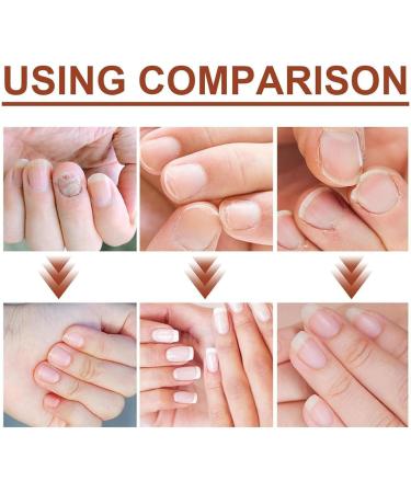 Nail Oil Cuticle 30ml with Herbal Extract Cuticle Oil for Nails Jojoba Nail Cuticle Oil Nail Oil Soothe Moisturize with Dropper Design for Dry Rough Nail Care Repair - Buy Online on SooperMarket.com