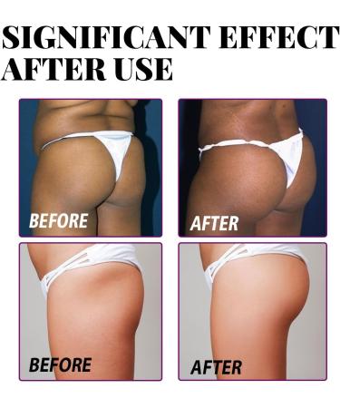 Firming Butt Lifting Cream Nourishing Plant Extracts Skin Brightening 10ml X 4 Tightening Muscles Quick Absorption - Buy Online on SooperMarket.com