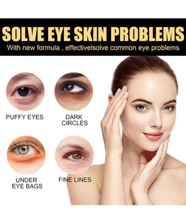 C lyn Instant Firmx Eye Tightener | Reduce Eye Bags & Puffiness | Anti-Aging Eye Cream for All Skin Types (2PCs) - Best International Shipping - Buy Online on SooperMarket.com