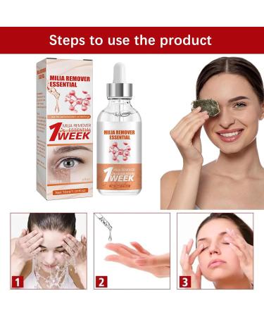 Speedy Milia Remover Milia Remover Milia Remover Under Eyes Milia Spot Serum for Face Helps Dissolve and Reduce Milia Dark Spot Remover to Reduce Milia Dark Circles Under Eye for Women & Men - Buy Online on SooperMarket.com