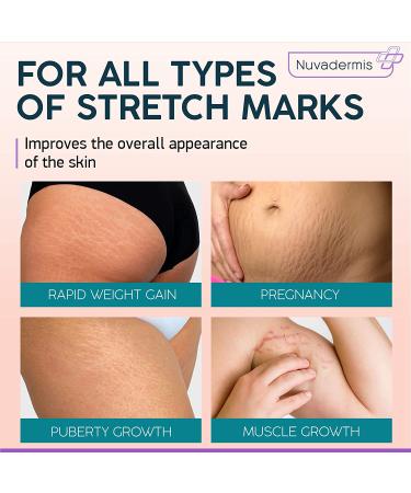 Stretch Mark Cream - Maternity Skin Care with Collagen, Jojoba, and Olive Oil - Prevents and Fades Stretch Marks - Hydrating Belly Lotion for Pregnant Women - 4 oz - Buy Online on SooperMarket.com