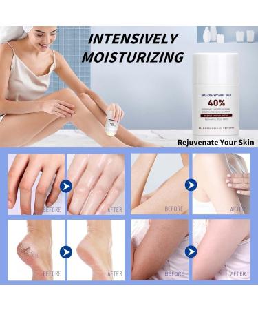 Urea Foot Cream Cracked Heel Balm Urea 40% Cream Cracked Heel Repair Cream Feet Skin Remover Callus Remover Foot Cream for Dry Skin Moisturizing Crack Cream Foot Care - Buy Online on SooperMarket.com