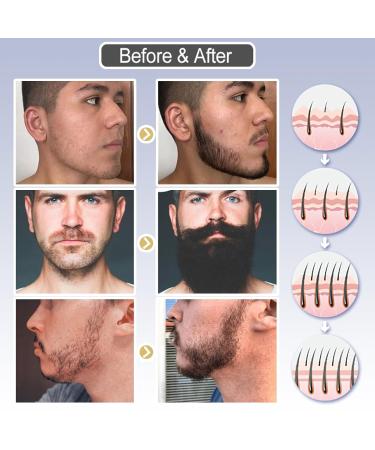 Beard Growth Serum for Men - Accelerate Beard Growth with 30ml Beard Oil & Hair Growth Formula - Buy Online on SooperMarket.com