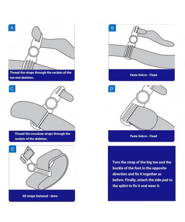 Orthopedic Toe Bunion Corrector Set Adjustable Day/Night Support for Pain Relief and Toe Alignment - Buy Online on SooperMarket.com