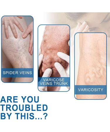 Varicose Vein Treatment Spray & Serum - 2 x 20ml for Spider Veins Relief | Effective Vein Care Cream - Buy Online on SooperMarket.com