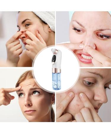 Visiblurry Electric Black Head Remover - Electric Extractor Tool Adjustable Rechargeable Remover with 6 Suction for Skincare for Women and Men - Buy Online on SooperMarket.com