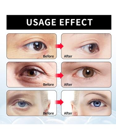 Instant Eye Tightener - Eye Bag Cream - Instant Firm Eye Cream for Dark Circles and Reduce Puffiness - Fade Fine Lines - Tightens and Smoothes Fine Lines for Women/Men - Buy Online on SooperMarket.com