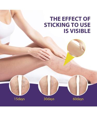 Varicose Vein & Spider Vein Cream | Capillary Health Treatment | Improve Circulation 0.7oz - Buy Online on SooperMarket.com