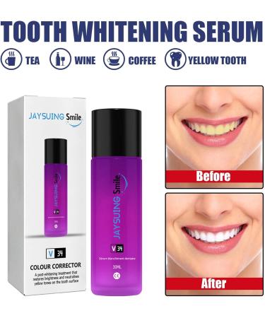 Teeth Whitening Serum - Brighten, Reduce Yellowing, and Cleanse Gums - Buy Online on SooperMarket.com