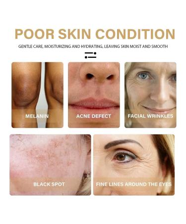 2022 Turmeric Dark Spot Corrector Serum for Face - Natural Skin Care Moisturizing Serum (2PCS-60ml) - Buy Online on SooperMarket.com