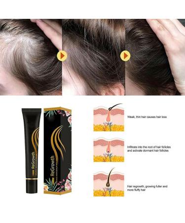 20ml Organic Hair Regrowth Serum Roller Set | Herbal Scalp Intense Roll-On for Men & Women | Triple Massager Hair Growth Essence (3PCs) - Buy Online on SooperMarket.com