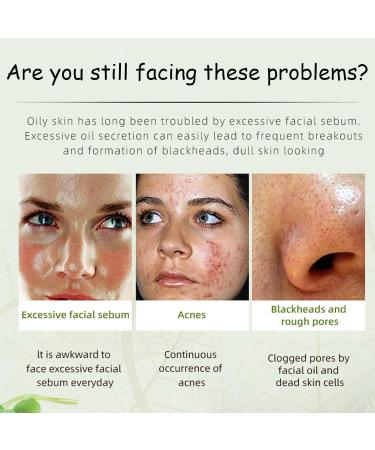 Acne Cream Moisturiser Face Cream Spot Cream Mens Moisturiser Tea Tree Cream Spot Cream For Acne Cream Moisturiser for Women Men Teenagers Dilute Face Prone Spot Marks Balance Facial Oil Cream - Buy Online on SooperMarket.com