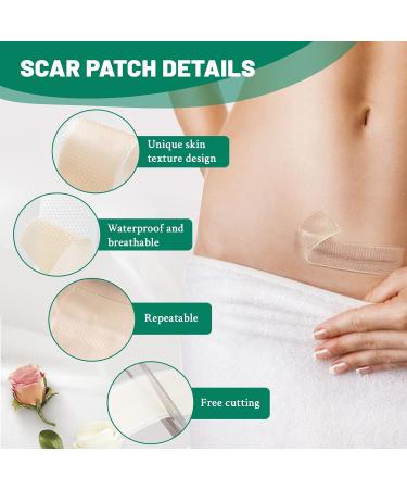3 Rolls Silicone Scar Sheets(1.6" x 60" Each) Silicone Patches for Scars Reusable Scar Removal Strips for Prevention and Repair - Buy Online on SooperMarket.com